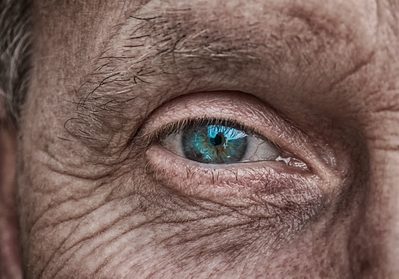 Age-It